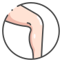Cellulitkezelés
